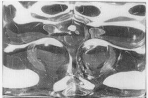 Anatome R VI image