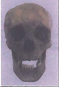 Deformed Paracas Skull image